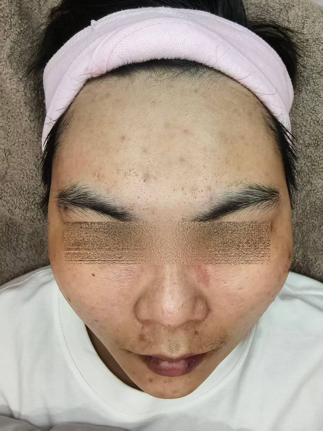 05/29-6/18 — Before